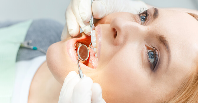 Everybody Smiles | Bonding / White Fillings