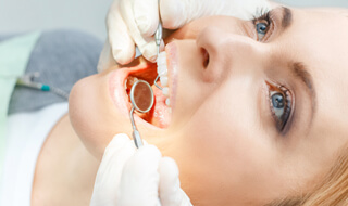 Everybody Smiles | Bonding / White Fillings