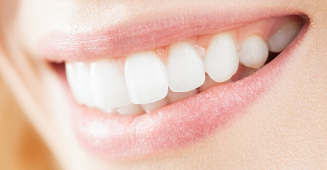 Everybody Smiles | Crown Lengthening
