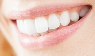 Everybody Smiles | Crown Lengthening