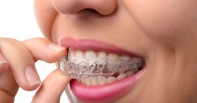 Everybody Smiles | Invisalign