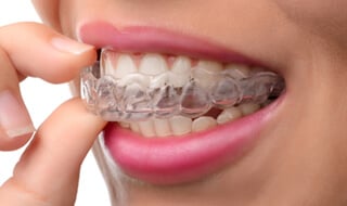 Everybody Smiles | Invisalign